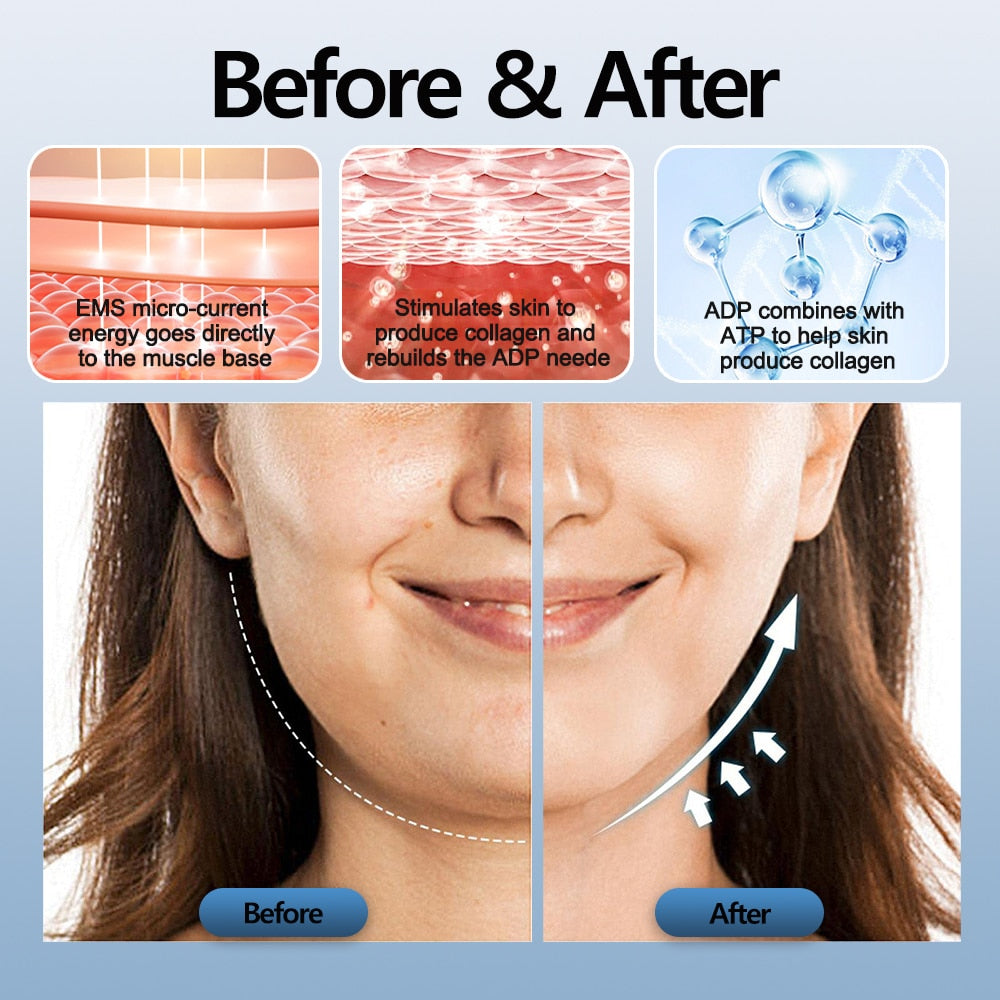 V-Face Beauty Device
